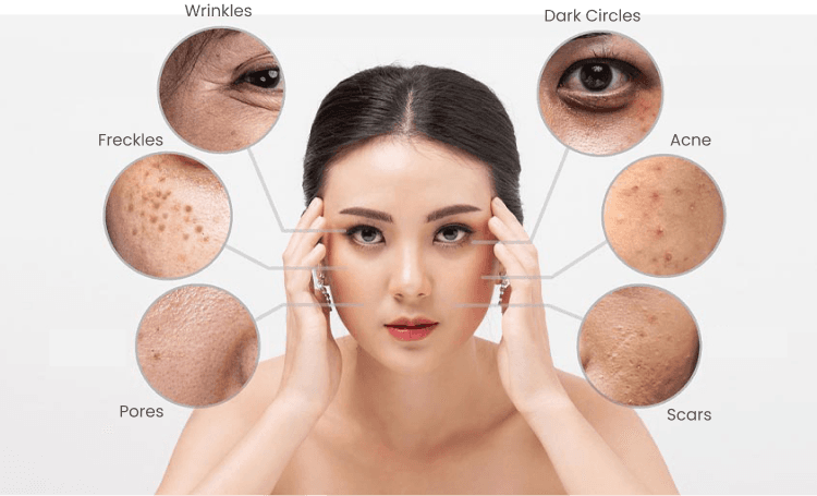 Skin Problems